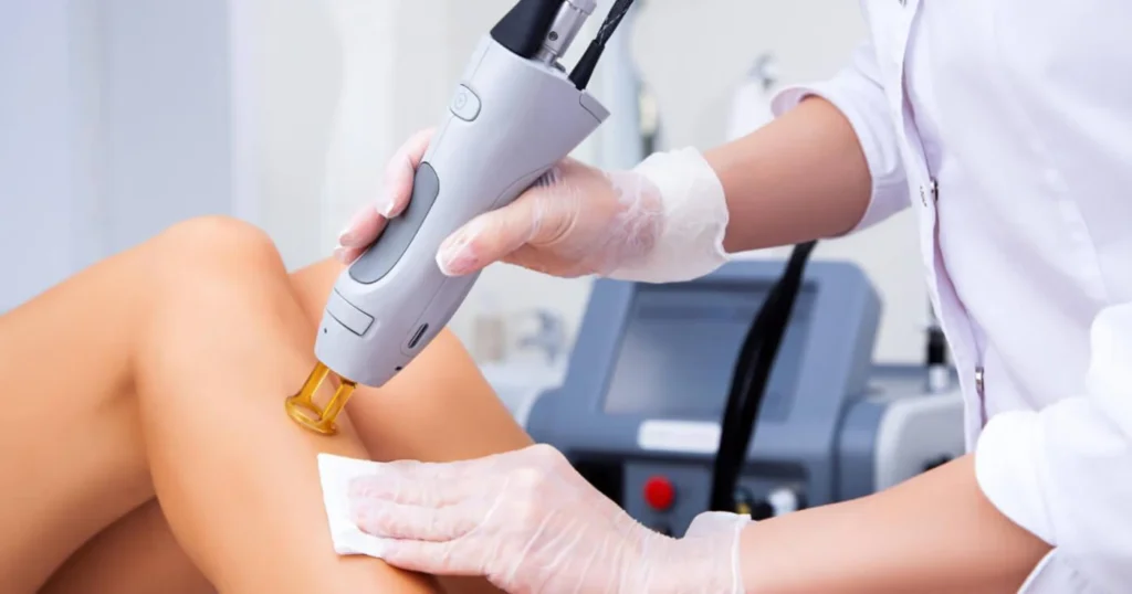 Laser Hair Removal Machine