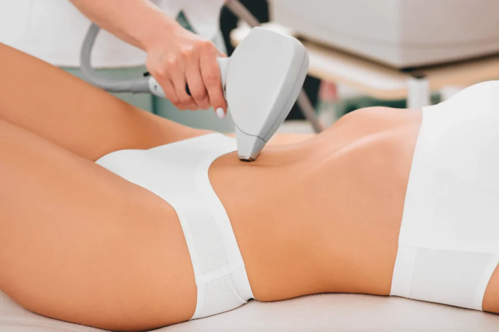 Epilation Laser Montreal