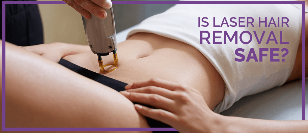 Laser Hair Removal Montreal