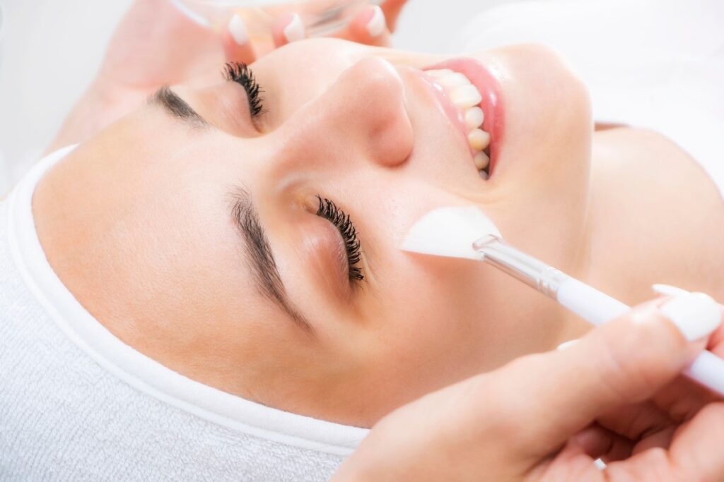 Chemical Peel Before and After