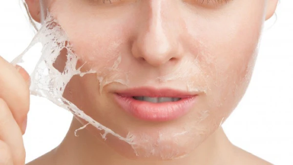 Chemical Peel at Home
