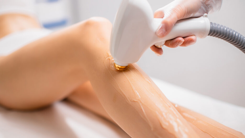 Épilation au laser Montréal