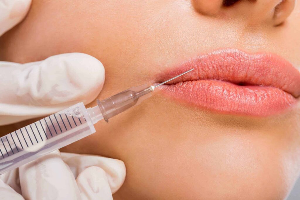 Lip Injections