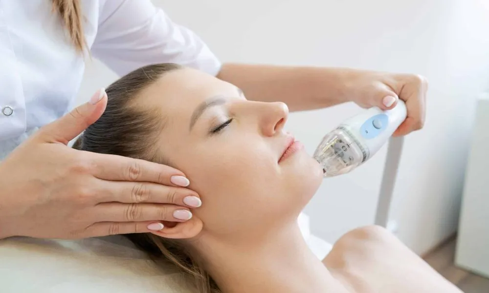 Laser Acne Marks