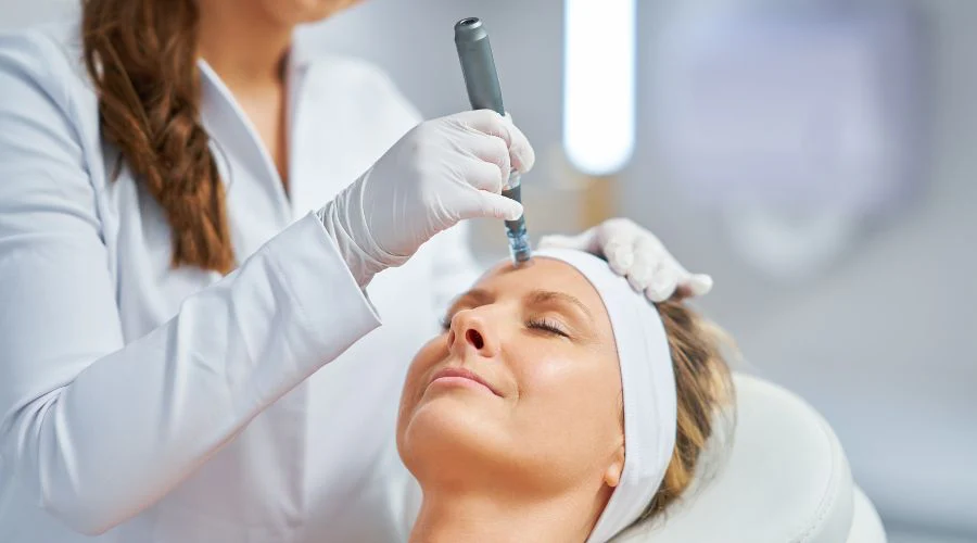 Microneedling Pen