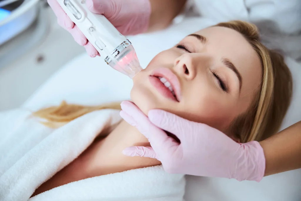 Microneedling Montreal