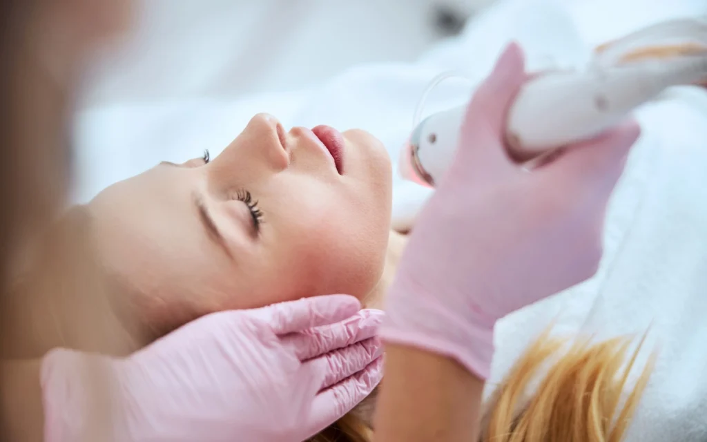 RF Microneedling Near Me