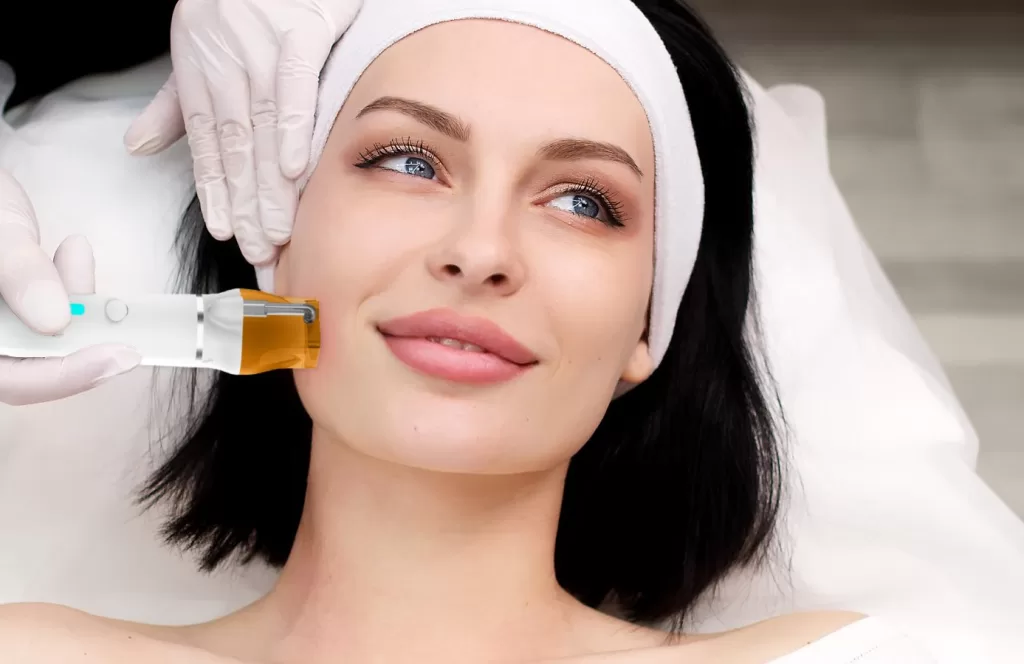 RF Microneedling Machine