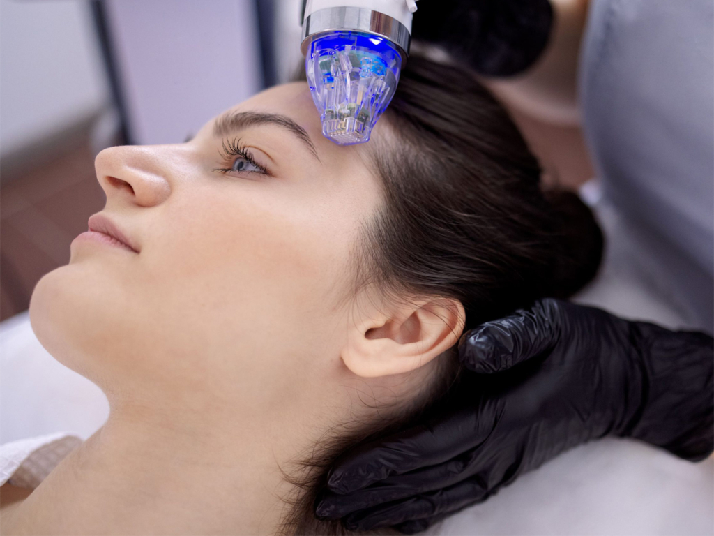 Exosomes Microneedling